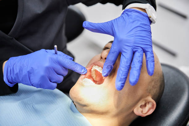 Best Emergency Dental Care for Broken or Chipped Teeth in Williamsport, IN